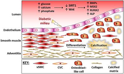 The Interplay of SIRT1 and Wnt Signaling in Vascular Calcification